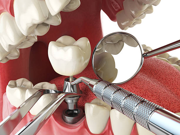 Best Emergency Treatment for Jaw Pain or Injury in Sweetwater, TN